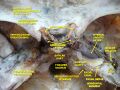 Tympanic cavity. Facial canal. Internal carotid artery.