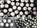 Gastroenteritis viruses