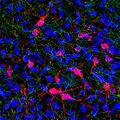Serotonin transporter in green, tyrosine hydroxylase in red, and nuclear DNA in blue in a region of rat brain