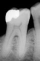 Tooth enamel