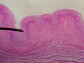 Vagina mucosa