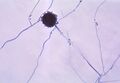 Aspergillus niger under a microscope