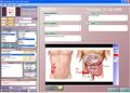 Medical privacy