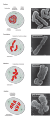 Stages of early mitosis in a vertebrate cell with micrographs of chromatids