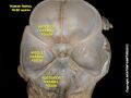 Cranial endobasis of a 19-20 weeks foetus
