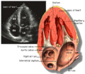Apical 4 chamber view of the heart