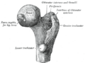 Femoral head