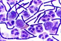 Gram stain of Bacillus anthracis