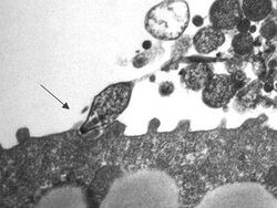 Mycoplasma p.
