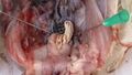 Infectious bursal disease