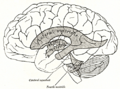 Coronal section of lateral and third ventricles
