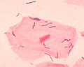 Lactobacillus sp