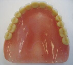 Maxillary Complete Denture