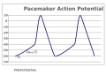 Graph of a pacemaker potential.