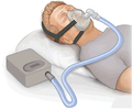 Continuous positive airway pressure
