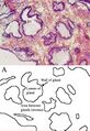 Microscopic glands of the prostate