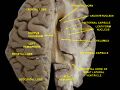 Thalamus