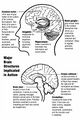 Autism brain