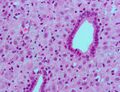 Endometrium