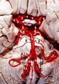 Human brainstem blood supply description