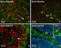Phenotypes of proliferating cells in the Rostral Migratory Stream and Dentate Gyrus
