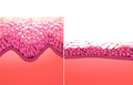 Vaginal mucosa normal vs menopause