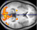 Functional magnetic resonance imaging
