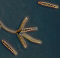 Exserohilum rostratum