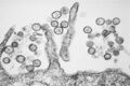 Sin Nombre virus under a transmission electron microscope
