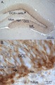 Doublecortin expression