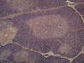 Thymus