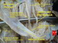 Ansa cervicalis