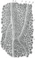 Gray's Anatomy illustration of bone lacunae