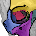 Sphenoid bone