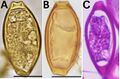 Trichuris trichiura eggs, including HE stain