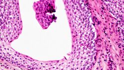 Epithelial Tissues Transitional