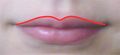 Cupid's Bow of the Mouth
