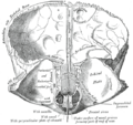 Anatomical drawing of arachnoid granulations