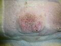 Mammary tumor in a veterinary pathology case