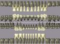 Primary dentition