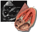 Transthoracic echocardiogram