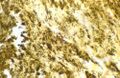 Blood culture negative endocarditis