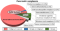 Relative incidence of pancreatic neoplasms