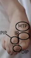 Interphalangeal joints of the foot