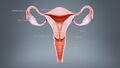 3D Medical Animation of Uterus