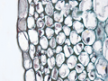 Collenchyma cells