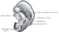 Otoplasty