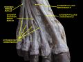 Extensor hallucis longus muscle