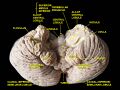 Flocculus