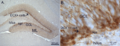 Doublecortin expression
